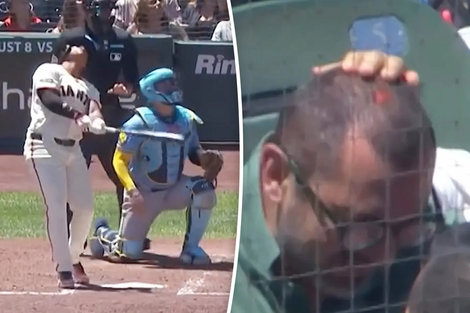 Giants fan left bloody after taking foul ball off dome piece
