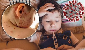 Alarm u srpskim vrtićima - Širi se virus! Roditelji u panici zbog opake zaraze, a evo koji je prvi simptom