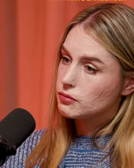 "Molila sam Boga da me neko ubije samo da bol prestane": Stefani je preživela erupciju vulkana, a onda joj je majka saopštila najgore vesti "Onesvestila sam se"