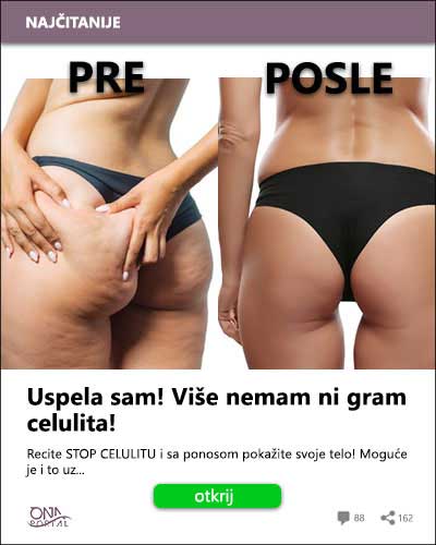 Celulit u menopauzi: 5 rešenja koja stvarno rade