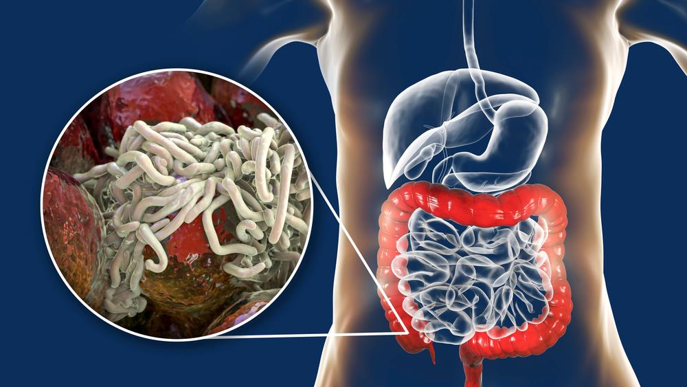 Kako očistiti debelo crevo za 15 minuta: Pet najboljih načina