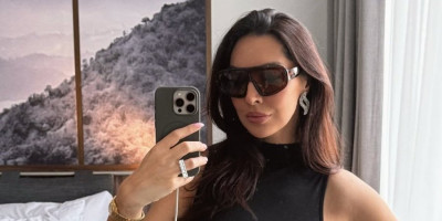 "Nisam sto posto prirodna": Pevačica otkrila šta je sve na sebi korigovala