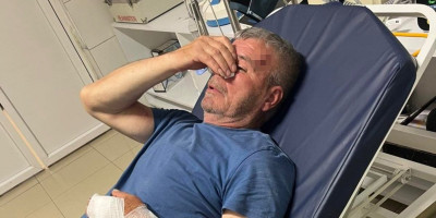 Zastrašujuće! Albanac pretukao Srbina sa KiM dok je štitio dete - dokle ide teror Kurtijevih sledbenika?! (FOTO)