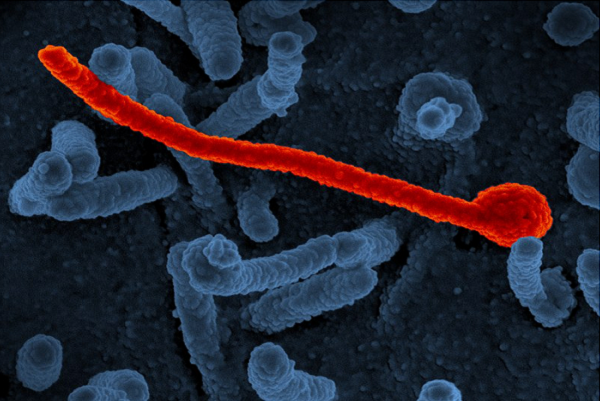 Podgotovkite za spravuvanje so ebola ne se dokaz za odnapred planirana epidemija