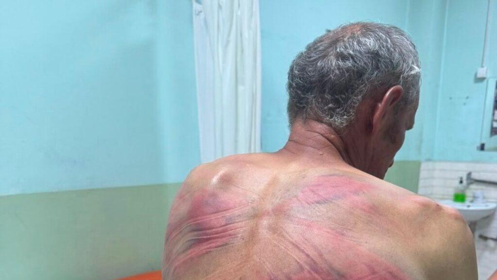 Zubin Potok: Albanski policajci se iživljavali nad Srbinom, tražili da prizna „ratni zločin“