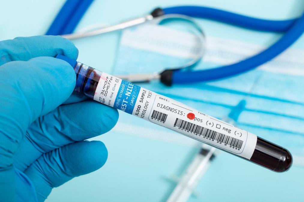 ALARMANTNO! VIRUS ZAPADNOG NILA ŠIRI SE EVROPOM: Više od 10 zemalja prijavilo slučajeve zaraze