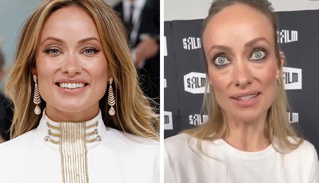 Novi izgled glumice zgrozio javnost: Smršala do neprepoznatljivosti, fanovi zabrinuti - "Izgleda kao medicinski leš koji je oživeo"