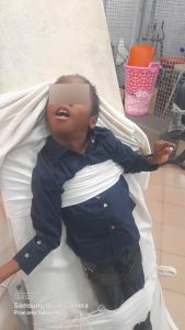Côte d’Ivoire-AIP/ L’infirmité motrice cérébrale, un combat quotidien entre souffrance familiale, prise en charge médicale et défis sociaux (Dossier)