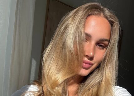 Kako ublažiti hiperpigmentacije na licu i ujednačiti ten?