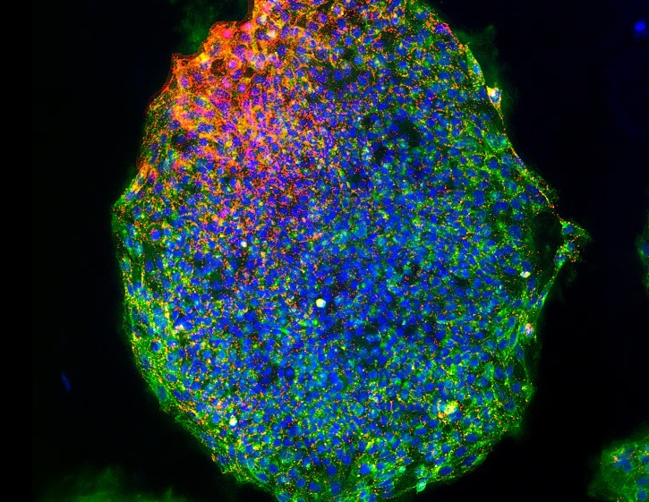 Are we on the brink of ending aging? Yes and no