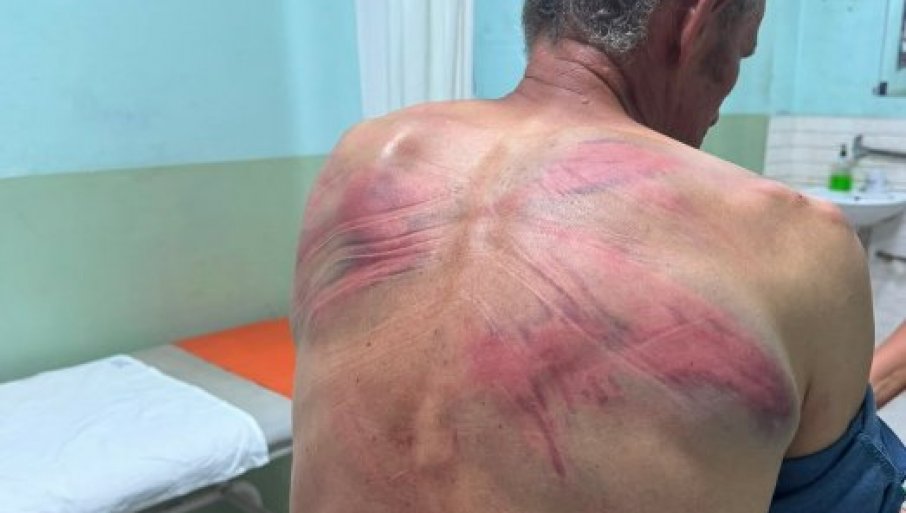 SUSPENZIJA POLICAJACA NIJE DOVOLjNA ZA TAKAV ZLOČIN Simić: Potrebna odgovornost pred sudom