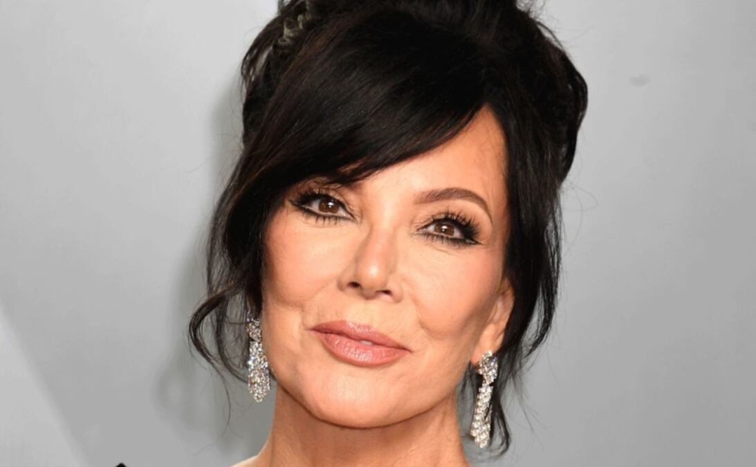 "Lice Kris Džener počelo je da popušta, bes kipti iz nje": Godinu dana nakon što je spiskala 100 000 dolara na fejslifting, već sve puca