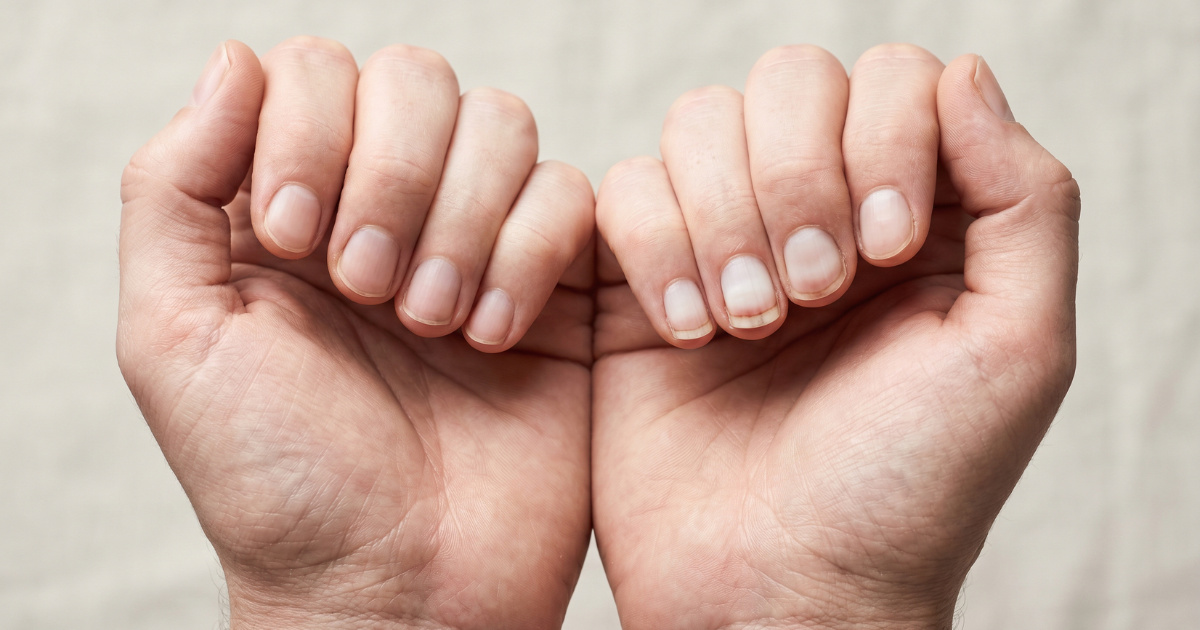 Jedna promjena na noktima može ukazivati na probleme sa srcem ili jetrom