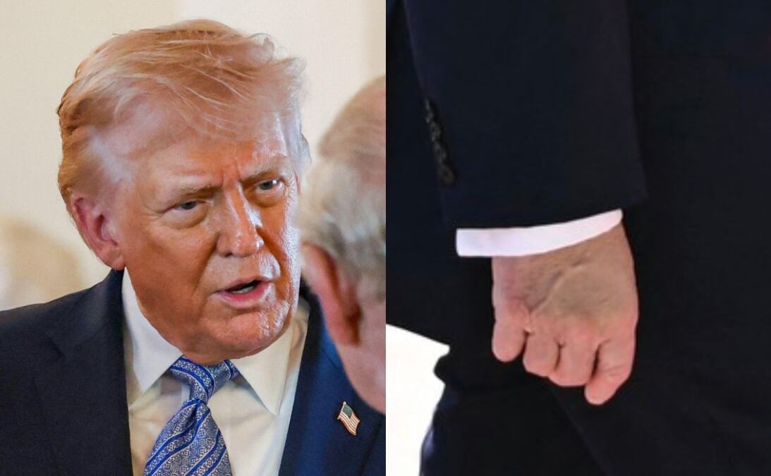 Donald Tramp opet viđen sa modrom rukom prekrivenom šminkom: Evo šta se stvarno događa sa zdravljem predsednika SAD