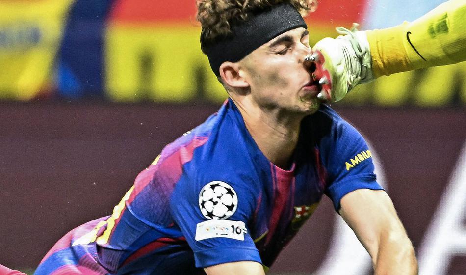 Zvezdnik dobil kopačko v obraz, tla so se obarvala rdeče