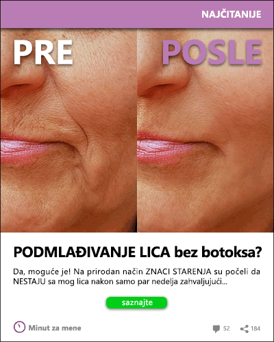 Bore oko usana koje menjaju izraz lica – šta pomaže?