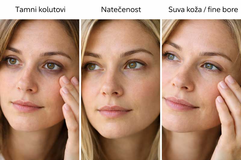 Najbolji serum za podočnjake – šta zapravo treba da tražite?