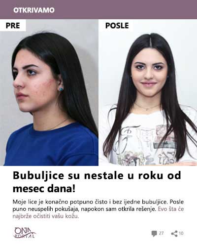 Najbolji tonik za lice – TOP preporuke