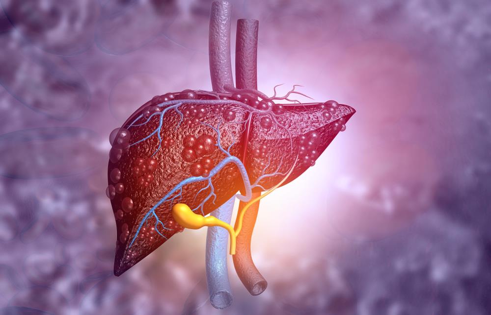 Hepatolog otkriva kojih 5 namirnica jetra obožava: Trebalo bi svaki dan da budu na stolu